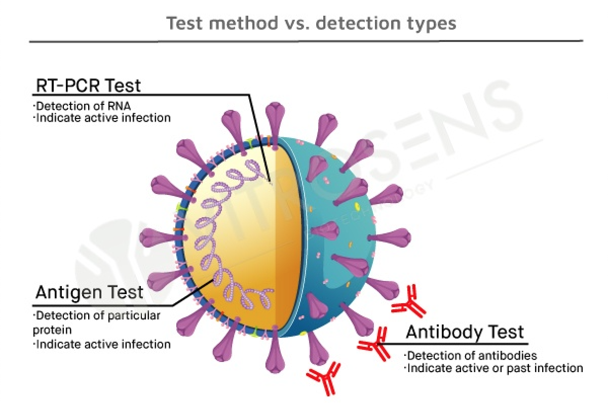 Rapid COVID-19 Test for Detection of Specific Antibodies IgM and IgG To  Novel Corona Virus SARS-CoV-2 Causing Covid-19 Pneumonia. Stock Image -  Image of blood, finger: 178875223